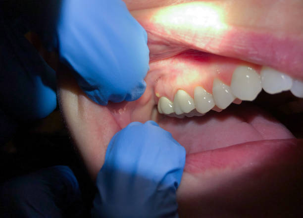 Best Emergency Broken Tooth Repair in Moody, TX