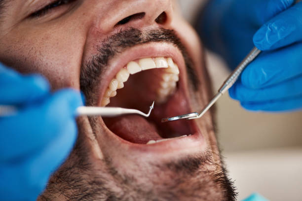 Best Weekend Emergency Dentist in Moody, TX