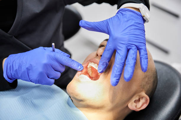 Best Emergency Root Canal Treatment in Moody, TX