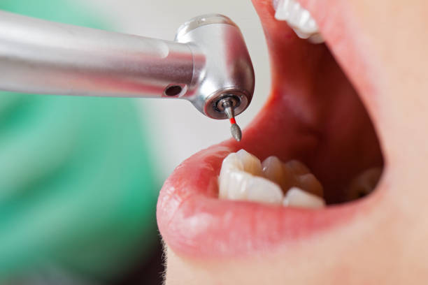 Best Emergency Dental Surgery in Moody, TX